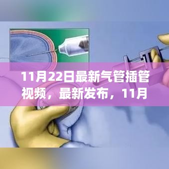 最新气管插管技术视频教程发布，11月22日气管插管视频指南