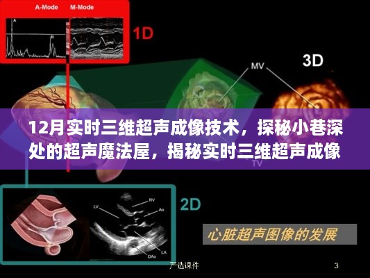 探秘小巷深处的超声魔法屋，实时三维超声成像技术的奥秘之旅揭秘