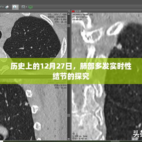 肺部多发实时性结节探究，历史视角的12月27日