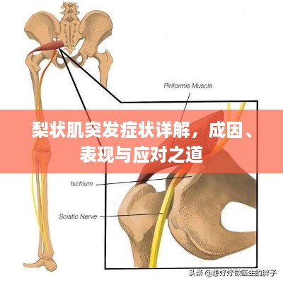 梨状肌突发症状详解，成因、表现与应对之道