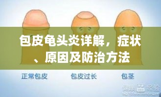 包皮龟头炎详解，症状、原因及防治方法